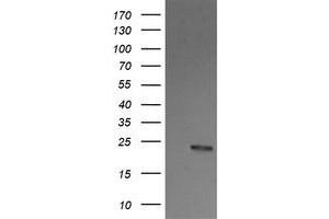 Image no. 3 for anti-V-Ral Simian Leukemia Viral Oncogene Homolog B (Ras Related, GTP Binding Protein) (Ralb) antibody (ABIN1500584)