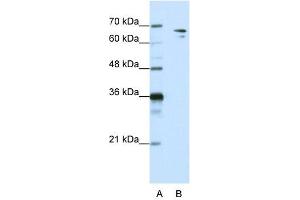 Image no. 2 for anti-Splicing Factor 1 (SF1) (N-Term) antibody (ABIN2776691)