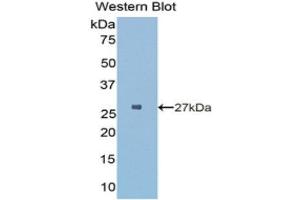 Image no. 1 for anti-HLA Class II DR alpha (HLA-DRA) (AA 28-232) antibody (ABIN1175589)