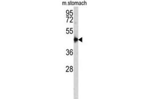 Image no. 3 for anti-Cathepsin E (CTSE) antibody (ABIN3002688)
