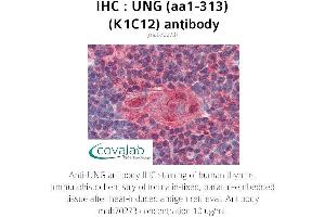 Image no. 2 for anti-Uracil-DNA Glycosylase (UNG) (AA 1-313) antibody (ABIN1723199)