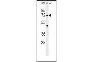 Image no. 4 for anti-Galactosamine (N-Acetyl)-6-Sulfate Sulfatase (GALNS) (AA 243-271), (Middle Region) antibody (ABIN952441)