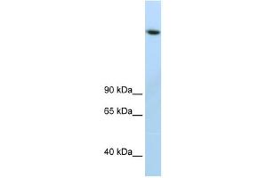 Image no. 1 for anti-Lysine (K)-Specific Demethylase 3B (KDM3B) (C-Term) antibody (ABIN925919)