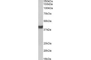Image no. 2 for anti-Troponin T2, Cardiac (TNNT2) (C-Term) antibody (ABIN5539507)