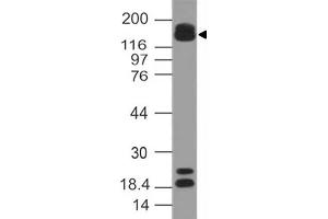 ARID5B Antikörper  (AA 430-621)