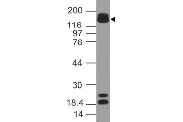 anti-AT Rich Interactive Domain 5B (MRF1-Like) (ARID5B) (AA 430-621) antibody