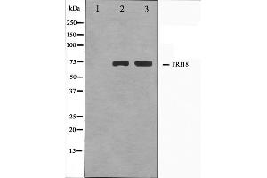 Image no. 2 for anti-Midline 1 (MID1) (N-Term) antibody (ABIN6265724)