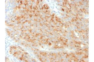Image no. 3 for anti-Mismatch Repair Protein 2 (MSH2) (AA 224-313) antibody (ABIN6940677)