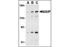 Image no. 2 for anti-NLR Family, Apoptosis Inhibitory Protein (NAIP) (C-Term) antibody (ABIN500306)