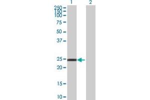RNF166 Antikörper  (AA 1-237)