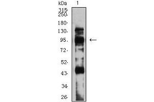 Image no. 3 for anti-Glutamate Receptor, Metabotropic 8 (GRM8) (AA 440-583) antibody (ABIN5611162)