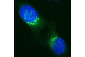 Image no. 2 for anti-USO1 Homolog, Vesicle Docking Protein (USO1) (Internal Region) antibody (ABIN351345)
