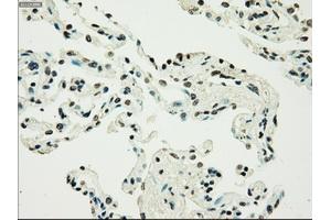 Image no. 11 for anti-Premelanosome Protein (PMEL) antibody (ABIN1500300)