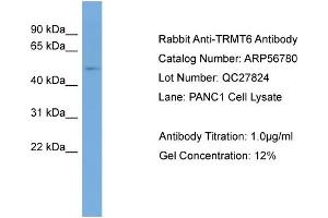 Image no. 2 for anti-tRNA Methyltransferase 6 Homolog (TRMT6) (Middle Region) antibody (ABIN2786898)