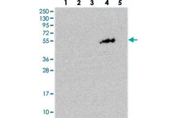 anti-PiggyBac Transposable Element Derived 4 (PGBD4) antibody