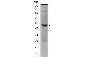 Image no. 3 for anti-Tumor Necrosis Factor Receptor Superfamily, Member 8 (TNFRSF8) antibody (ABIN969019)