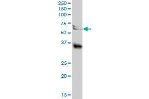 Image no. 3 for anti-Legumain (LGMN) (AA 1-433) antibody (ABIN519317)