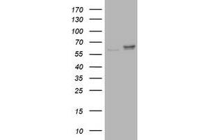 Image no. 1 for anti-Ribophorin II (RPN2) antibody (ABIN1500757)