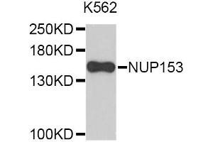Image no. 1 for anti-Nucleoporin 153kDa (NUP153) antibody (ABIN4904597)