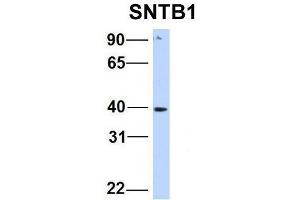 Image no. 1 for anti-Syntrophin, beta 1 (Dystrophin-Associated Protein A1, 59kDa, Basic Component 1) (SNTB1) (N-Term) antibody (ABIN2781530)