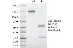 Image no. 4 for anti-Villin 1 (VIL1) (AA 179-311) antibody (ABIN6940871)