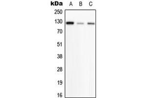 Image no. 1 for anti-Phosphorylase Kinase, beta (PHKB) (Center) antibody (ABIN2706801)