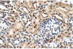 Image no. 2 for anti-Interferon-Induced Protein with Tetratricopeptide Repeats 3 (IFIT3) (N-Term) antibody (ABIN2782443)