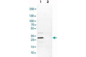 Image no. 4 for anti-SIX Homeobox 1 (SIX1) antibody (ABIN5587955)