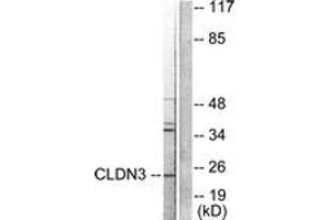 Image no. 3 for anti-Claudin 3 (CLDN3) (AA 171-220) antibody (ABIN1533226)