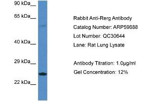 Image no. 1 for anti-RAS-Like, Estrogen-Regulated, Growth Inhibitor (RERG) (Middle Region) antibody (ABIN2788162)