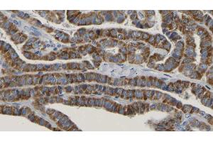 Image no. 1 for anti-RPTOR Independent Companion of mTOR, Complex 2 (RICTOR) (pThr1135) antibody (ABIN6256465)