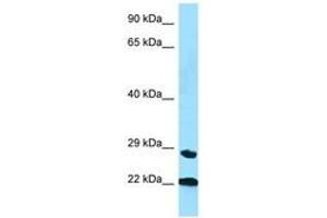 Image no. 1 for anti-Peptidylprolyl Isomerase C (Cyclophilin C) (PPIC) (AA 35-84) antibody (ABIN6748262)