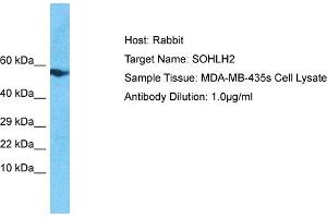 Image no. 1 for anti-Spermatogenesis and Oogenesis Specific Basic Helix-Loop-Helix 2 (SOHLH2) (N-Term) antibody (ABIN2792011)