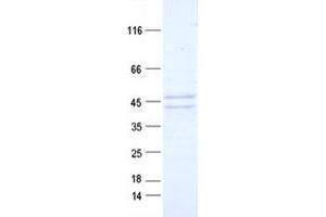 Keratin 19 (KRT19) protein (DYKDDDDK Tag)
