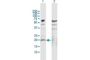 Image no. 1 for anti-Interleukin 19 (IL19) (AA 1-215) antibody (ABIN526183)