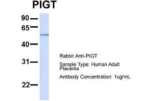 Image no. 1 for anti-Phosphatidylinositol Glycan T (PIGT) (C-Term) antibody (ABIN2782863)