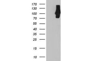 Image no. 2 for anti-Complement Component 1, S Subcomponent (C1S) antibody (ABIN2716891)