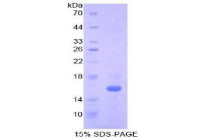 Image no. 1 for Interleukin 16 (IL16) (AA 1203-1322) protein (His tag) (ABIN1879804)