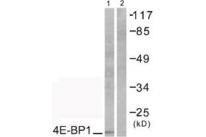 Image no. 3 for anti-Eukaryotic Translation Initiation Factor 4E Binding Protein 1 (EIF4EBP1) (Thr70) antibody (ABIN1847930)