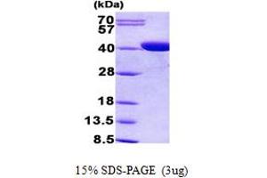 Image no. 1 for Coproporphyrinogen Oxidase (CPOX) (AA 111-454) protein (His tag) (ABIN5852918)