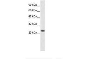 Image no. 1 for anti-Charged Multivesicular Body Protein 3 (CHMP3) (AA 28-77) antibody (ABIN6735908)