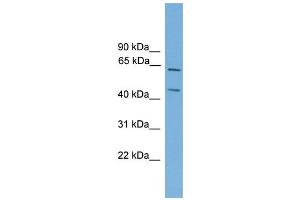 Image no. 1 for anti-REL proto-oncogene (c-Rel) (Middle Region) antibody (ABIN2779887)