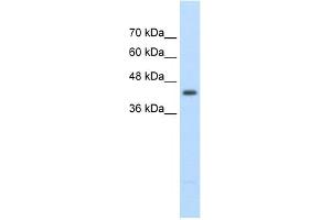 Image no. 1 for anti-Ureidopropionase, beta (UPB1) (Middle Region) antibody (ABIN2775431)