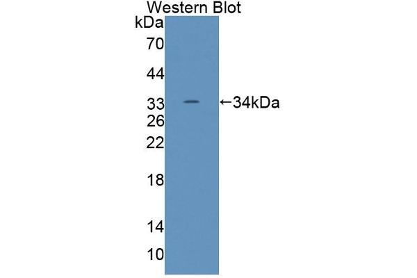 anti-ATP-Binding Cassette, Sub-Family G (WHITE), Member 8 (ABCG8) (AA 1-271) antibody