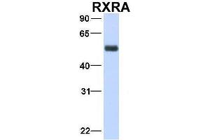 Image no. 4 for anti-Retinoid X Receptor, alpha (RXRA) (N-Term) antibody (ABIN2778244)