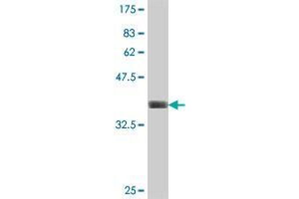 anti-Signal Peptide Peptidase-Like 2A (SPPL2A) (AA 31-129) antibody
