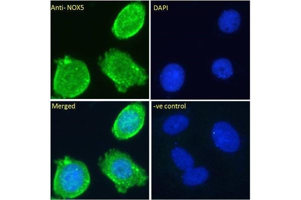 NOX5 Antikörper  (Internal Region)