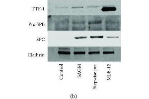 Surfactant Protein C 抗体  (AA 1-193)