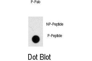 Image no. 1 for anti-NODAL Modulator 1 (NOMO1) (pSer1205) antibody (ABIN358491)