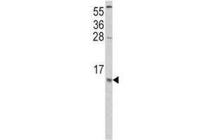 Image no. 5 for anti-Chemokine (C-C Motif) Ligand 2 (CCL2) (AA 62-89) antibody (ABIN3030482)